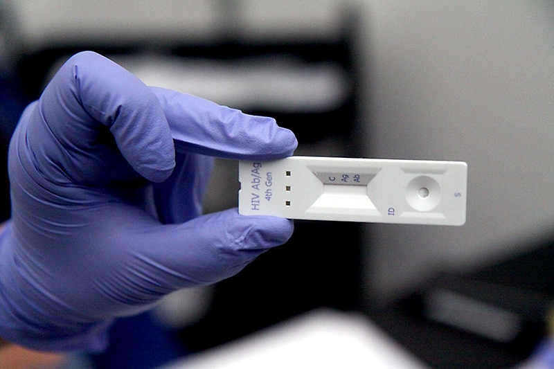 1 de diciembre: Nueva toma de Test Rápido de VIH (cupos limitados)